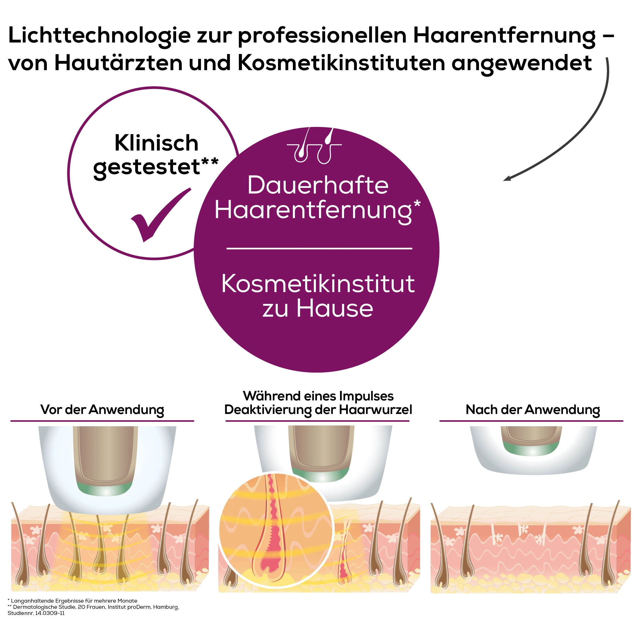 IPL-Haarentferner IPL 8500 – Dauerhafte Haarentfernung mit moderner Lichttechnologie